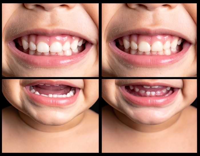 bebekler diş çıkarırken rahatlatma yöntemleri