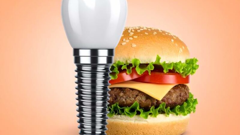 implant sonrası yemek ne zaman yenir