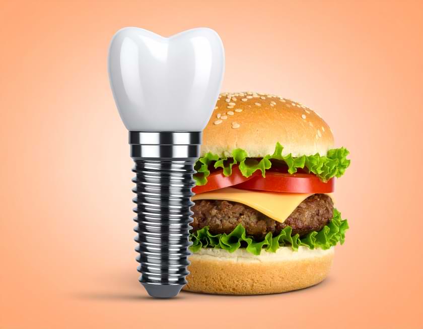 implant sonrası yemek ne zaman yenir