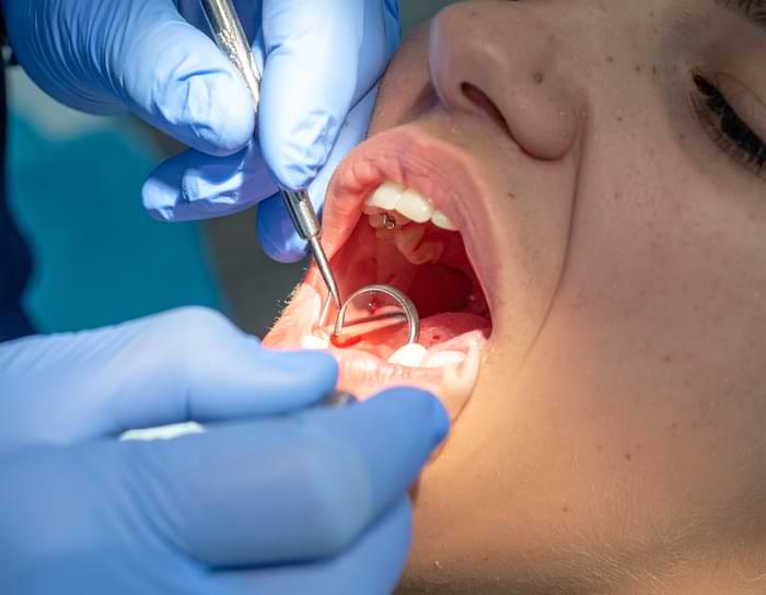 Kanama Ne Kadar Sürer?